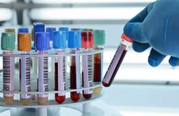 Extracciones de sangre en los CAPS