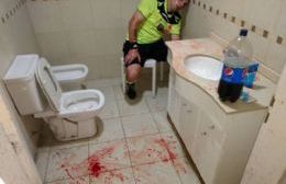 Federal B: Violencia pura en Juventud-Independiente