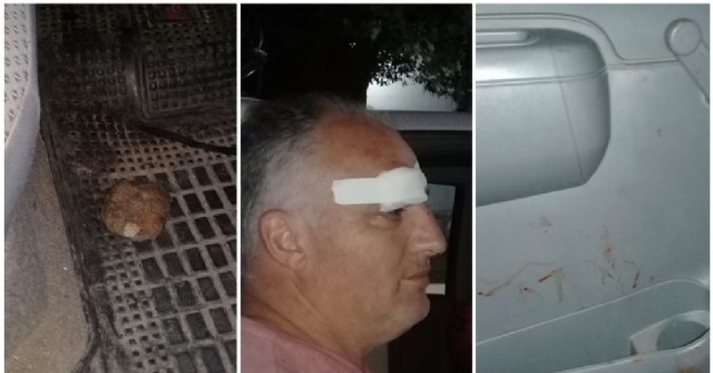 Atacaron a piedrazos a un funcionario municipal de Pergamino en pleno control del cumplimiento de la cuarentena