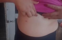 Conflicto en Nehuenche: víctimas muestran las heridas