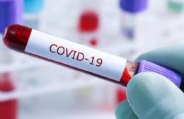 Reportan 120 nuevos contagios de Covid en nuestra ciudad
